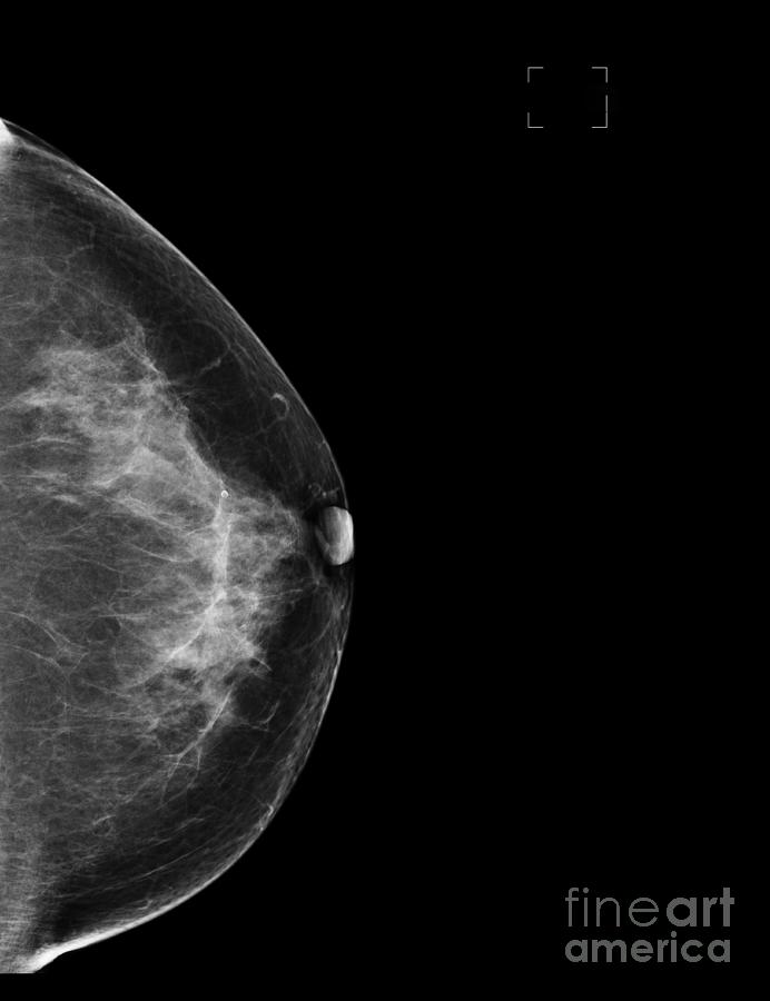 Mammography Services