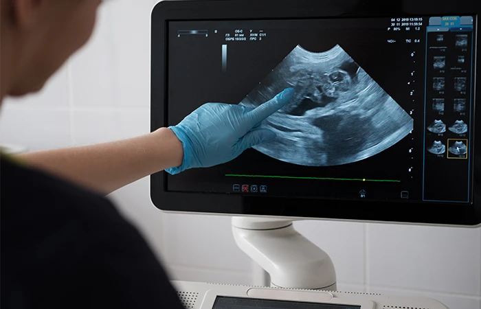 Sonography Services